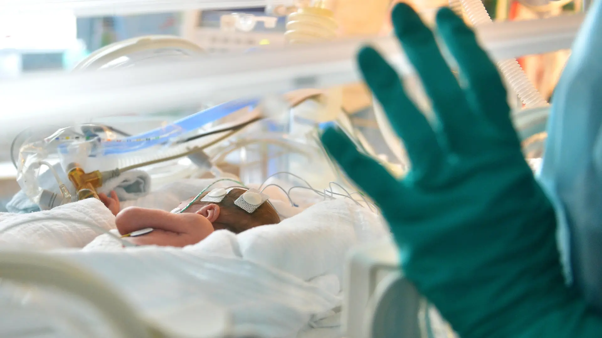 ARCHIV - 05.02.2013, Berlin: Ein zu früh geborenes Baby liegt  in der Neonatologie in einem Inkubator. Im Prozess gegen eine frühere Krankenschwester, die mehreren Frühchen unerlaubt Medikamente verabreicht haben soll, wird vor dem Landgericht in Marburg am Donnerstag (28.11.2019) das Urteil erwartet. Foto: Britta Pedersen/zb/dpa +++ dpa-Bildfunk +++