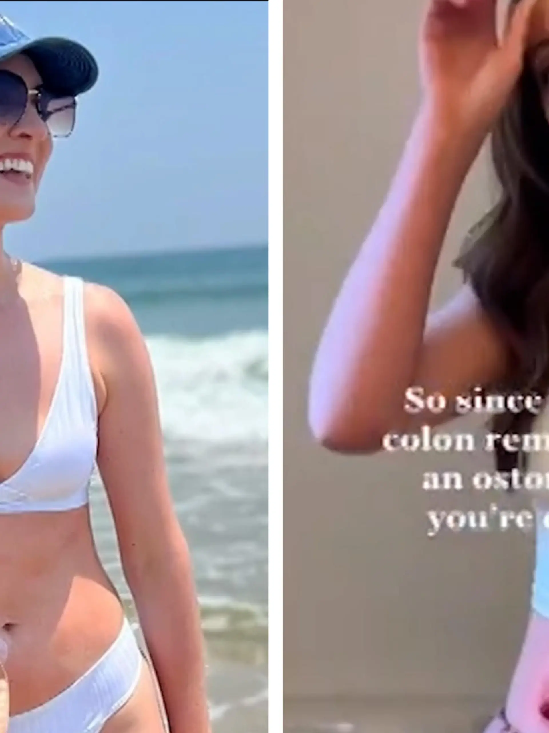 Influencerin Meghan Brown genießt das Leben – und das, obwohl sie unter Morbus Krohn leidet. Die chronische Erkrankung hat dafür gesorgt, dass sie ihren Dickdarm verloren hat. Deswegen hat sie nun einen künstlichen Darmausgang und muss einen Beutel für Kot und Urin am Bauch tragen.