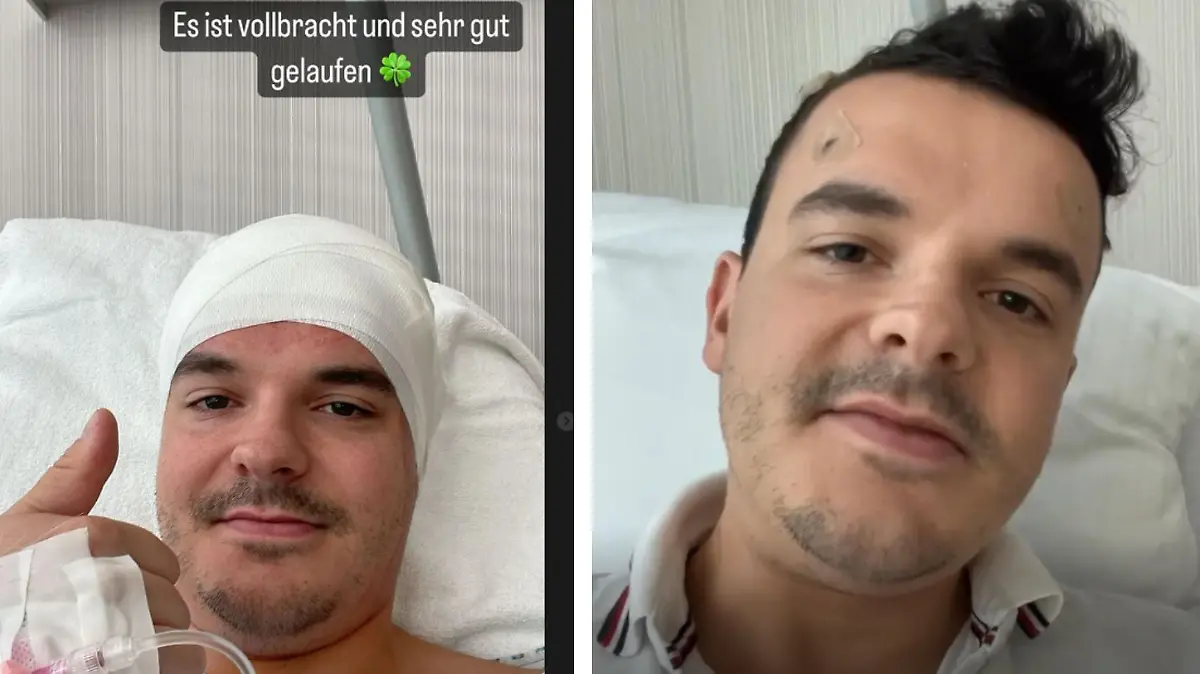 "Es ist vollbracht und sehr gut gelaufen", berichtet Jan seinen Fans auch in seiner Instagram-Story.