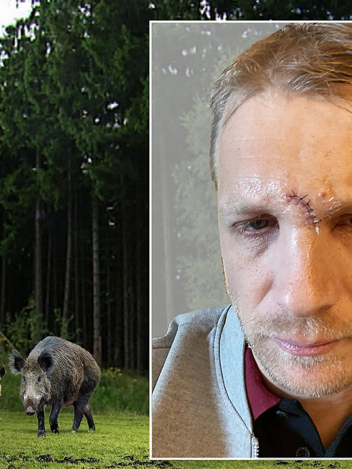 Oliver Pocher hat sich bei der Wildschwein-Jagd verletzt.