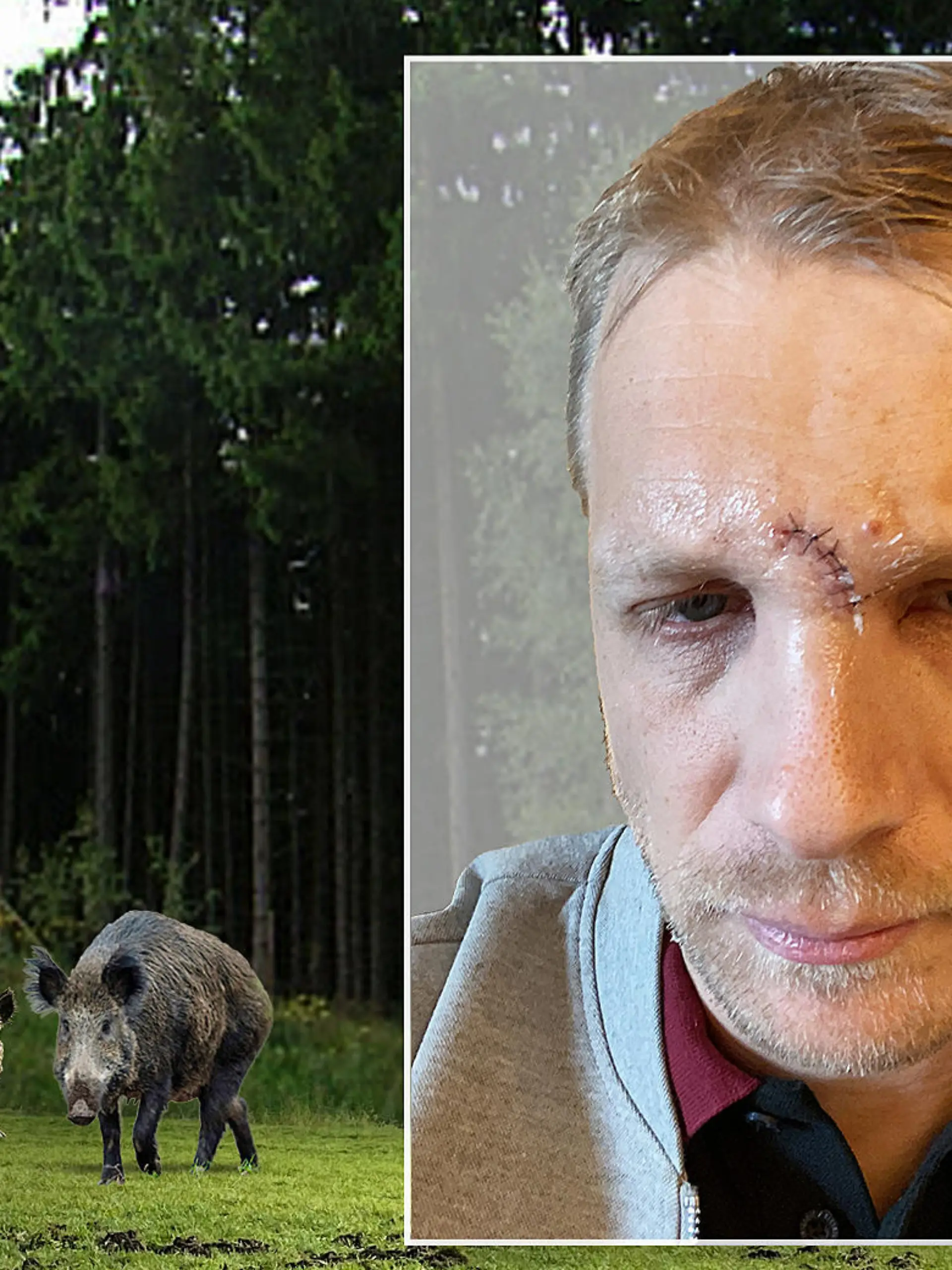 Oliver Pocher hat sich bei der Wildschwein-Jagd verletzt.