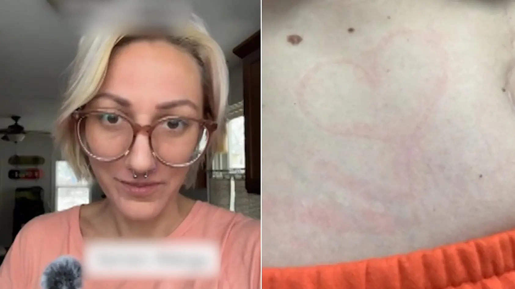 Allergie lässt Frau nicht intim werden