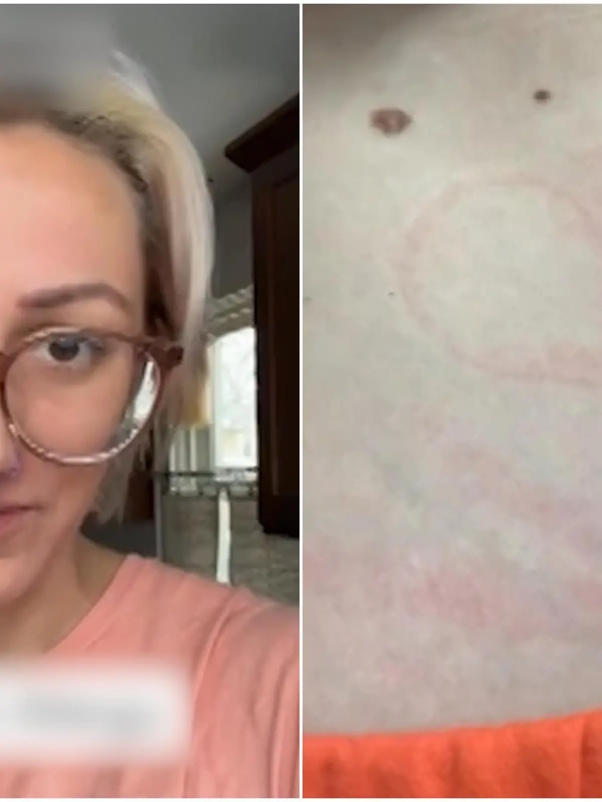 Allison Tennyson fragt sich, wie sie jemals Mama werden kann: Das Ehlers-Danlos-Syndrom, eine Bindegewebsstörung, löst bei ihr eine allergische Reaktion auf der Haut aus, sobald sie in Kontakt mit Sperma kommt. Ihr Körper reagiert mit dem Samen-Protein - die Folge sind schmerzhafte Ausschläge. Wie die 34-Jährige damit umgeht, zeigen wir euch im Video.