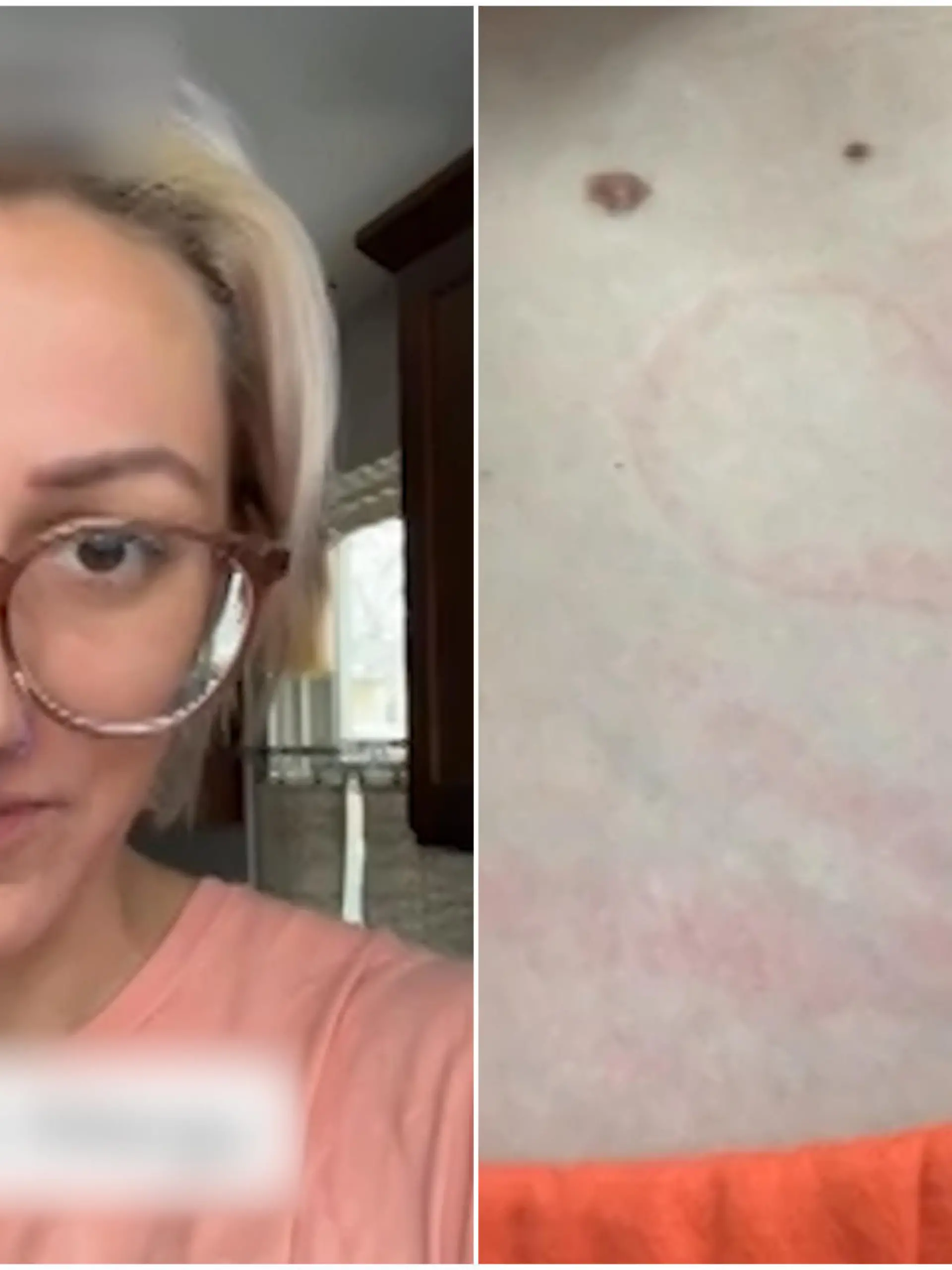 Allison Tennyson fragt sich, wie sie jemals Mama werden kann: Das Ehlers-Danlos-Syndrom, eine Bindegewebsstörung, löst bei ihr eine allergische Reaktion auf der Haut aus, sobald sie in Kontakt mit Sperma kommt. Ihr Körper reagiert mit dem Samen-Protein - die Folge sind schmerzhafte Ausschläge. Wie die 34-Jährige damit umgeht, zeigen wir euch im Video.