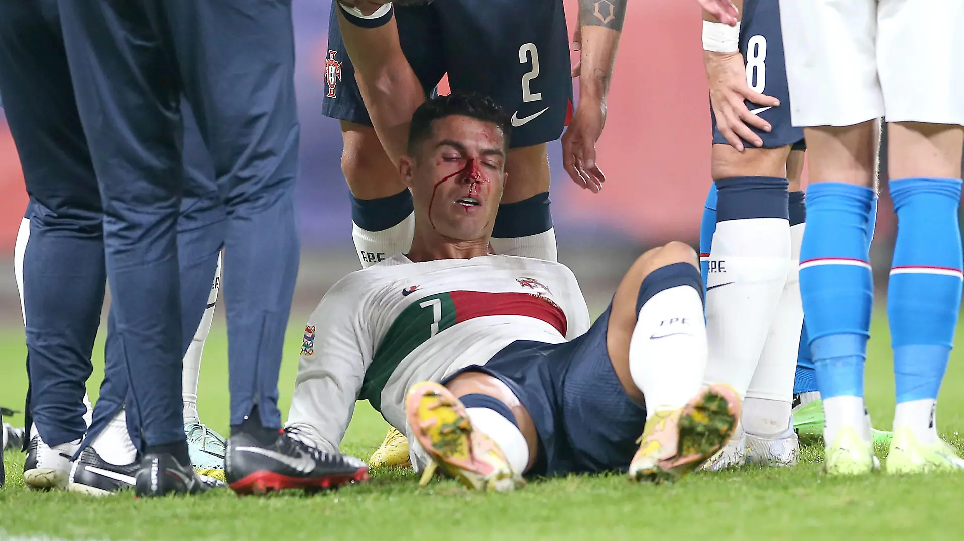 Fußball, Nations League, Tschechien - Portugal, Cristiano Ronaldo blutet nach Zusammenprall  24.09.2022, Fussball Länderspiel UEFA Nations League 2022/23, Tschechische Republik - Portugal, in der Fortuna Arena Prag. Cristiano Ronaldo Portugal verletzt nach Zusammenprall und muss behandelt werden *** 24 09 2022, football international match UEFA Nations League 2022 23, Czech Republic Portugal, at Fortuna Arena Prague Cristiano Ronaldo Portugal injured after collision and requires treatment