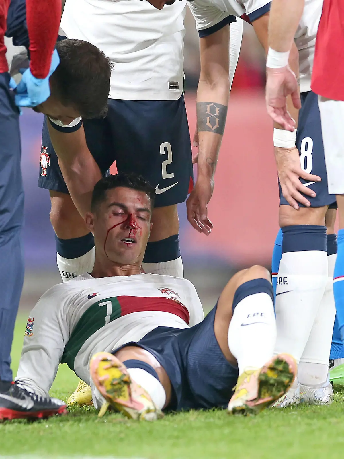 Fußball, Nations League, Tschechien - Portugal, Cristiano Ronaldo blutet nach Zusammenprall  24.09.2022, Fussball Länderspiel UEFA Nations League 2022/23, Tschechische Republik - Portugal, in der Fortuna Arena Prag. Cristiano Ronaldo Portugal verletzt nach Zusammenprall und muss behandelt werden *** 24 09 2022, football international match UEFA Nations League 2022 23, Czech Republic Portugal, at Fortuna Arena Prague Cristiano Ronaldo Portugal injured after collision and requires treatment