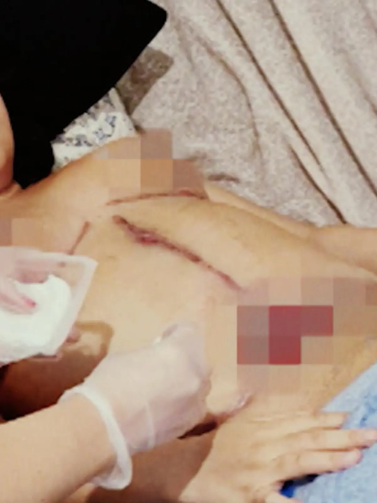 Zwei Monate lang eingesperrt in einem Krankenhaus, nach einer missglückten Operation, von einem Schönheitschirurg und seiner Geliebten, die sich als Ärztin ausgibt. Was Daiana Chaves in Rio de Janeiro durchmachen musste, erinnert an einen Horrorfilm.