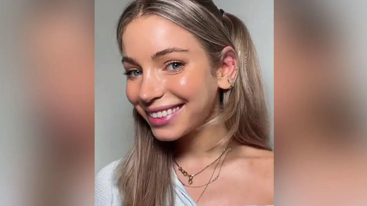 TikTokerin Isabelle Lux aus New York behauptet: Ich benötige kein Botox, um meine Falten zu bekämpfen.