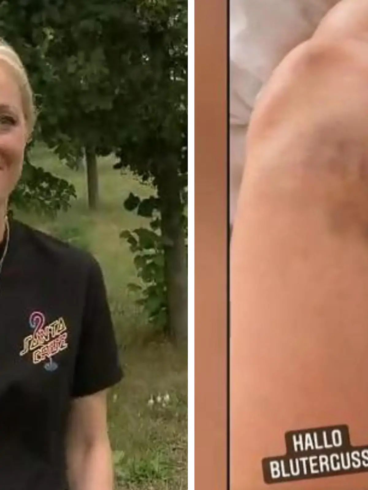 Ninja Warrior Promi-Special: Angela FInger-Erben zeigt ihren blauen Fleck