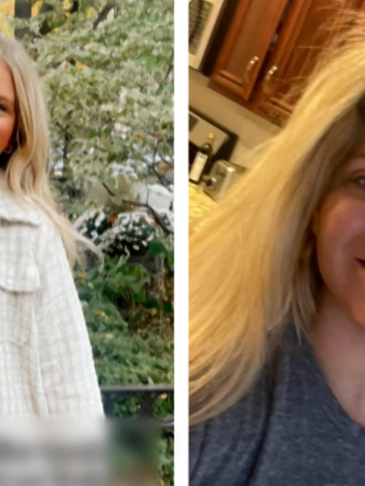 Sie wollte sich spontan das Kinn auffüllen lassen. Anna Brown sieht danach aus wie eine Comic-Figur. Mit ihren Followern teilt sie denn Weg ihrer Heilung. Beim nächsten Mal wird sie sicherlich zwei Mal nachdenken.