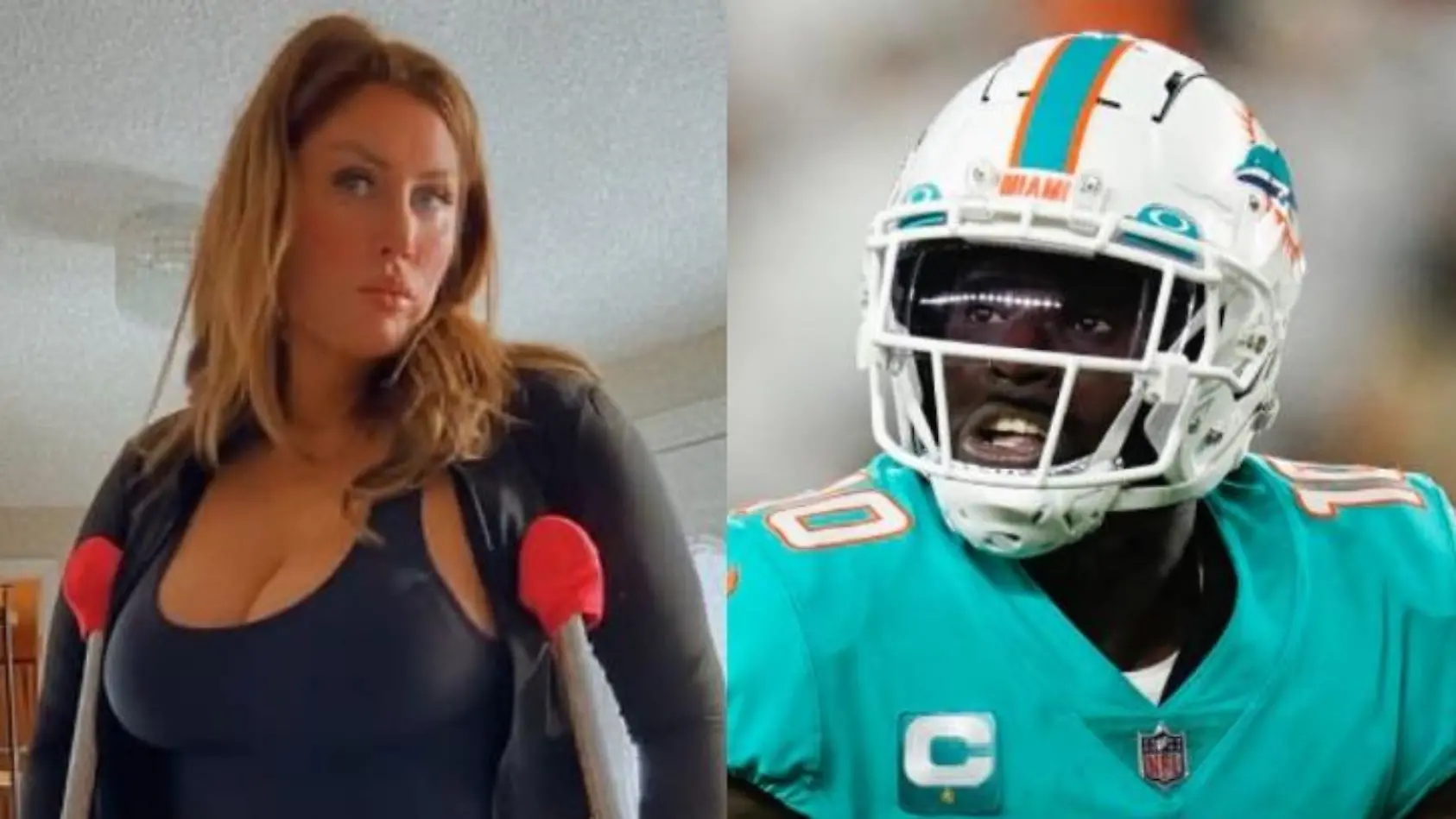 Hill soll Model Bein gebrochen haben