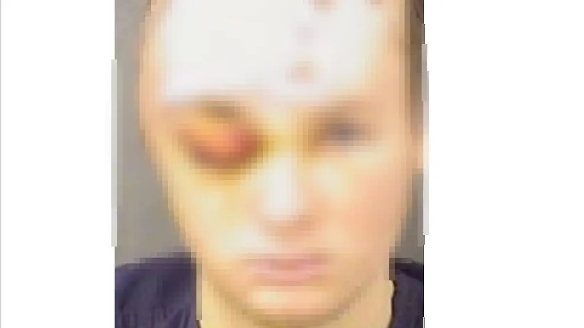 Dieser Mann soll die wehrlose Psychologin über Stunden gefoltert haben.