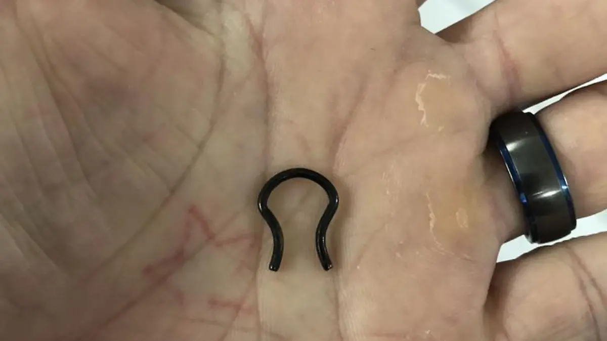 PIC FROM Kennedy News and Media (PICTURED: NOSE RING THAT JOEY LOST FIVE YEARS AGO AND WAS FOUND LODGED IN HIS LEFT LUNG AFTER IT WAS REMOVED) A piercings fanatic who woke up to find his nose ring had vanished in the night was horrified to discover it had been lodged in his LUNG for the last five years. Joey Lykins rushed to hospital at 2.30am last Tuesday [Aug 30th] through fear he had pneumonia after coughing so violently he ended up with back ache. Doctors carried out an x-ray and were stunned to spot the piece of jewellery that the 35-year-old thought had fallen out of his nose while he was sleeping in the upper lobe of his left lung.DISCLAIMER: While Kennedy News and Media uses its best endeavours to establish the copyright and authenticity of all pictures supplied, it accepts no liability for any damage, loss or legal action caused by the use of images supplied and the publication of images is solely at your discretion. SEE KENNEDY NEWS COPY - 0161 697 4266