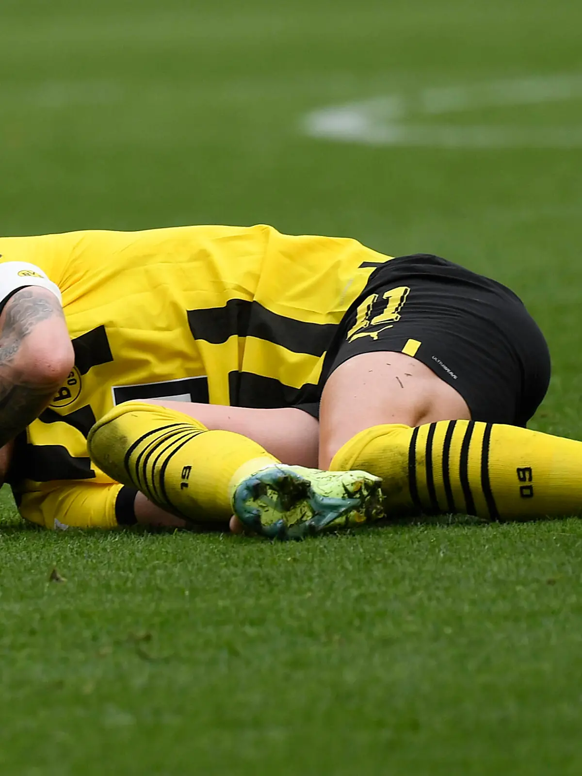 17.09.2022, Dortmund, Germany, Signal-Iduna-Park, BV Borussia Dortmund vs FC Schalke 04 - 1. Bundesliga, Marco Reus Borussia Dortmund verletzt Foto Ralf Treese DFB/DFL REGULATIONS PROHIBIT ANY USE OF PHOTOGRAPHS AS IMAGE SEQUENCES AND/OR QUASI-VIDEO. Dortmund Signal-Iduna-Park North Rhine-Westphalia Germany *** 17 09 2022, Dortmund, Germany, Signal Iduna Park, BV Borussia Dortmund vs FC Schalke 04 1 Bundesliga, Marco Reus Borussia Dortmund injured photo Ralf Treese DFB DFL REGULATES PROHIBIT ANY USE OF PHOTOGRAPHS AS IMAGE SEQUENCES AND OR QUASI VIDEO Dortmund Signal Iduna Park North Rhine Westphalia Germany PUBLICATIONxINxGERxSUIxAUTxONLY / 521_BVBS0420220917_016 / Treese-521 