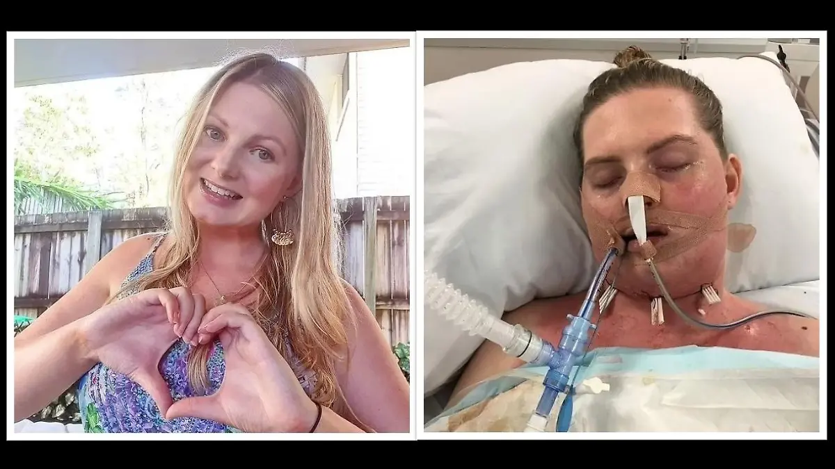 Caitlin Alsop aus Australien hatte einen entzündeten Weisheitszahn.