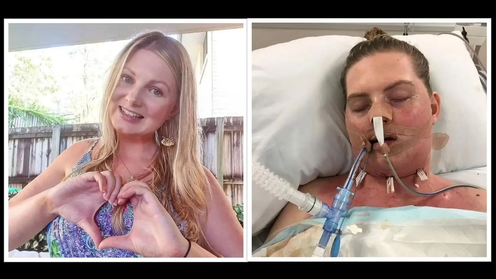 Caitlin Alsop aus Australien hatte einen entzündeten Weisheitszahn.
