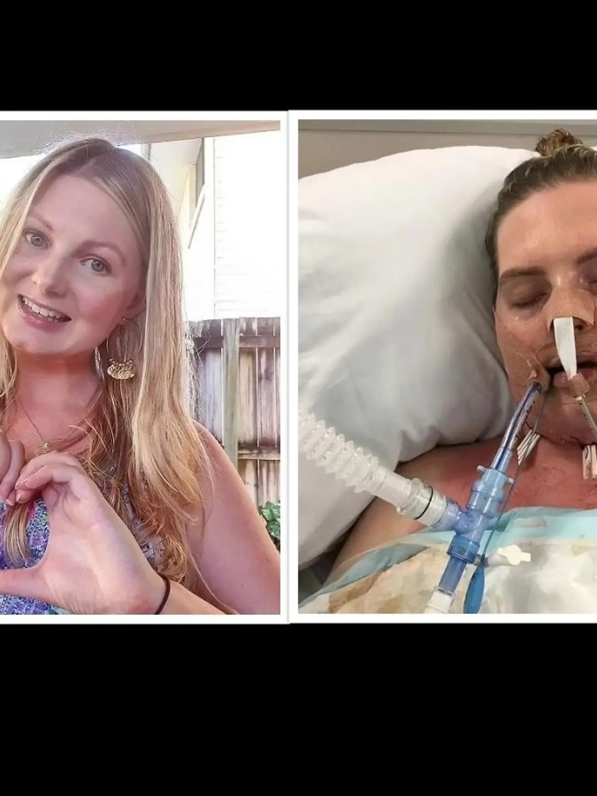 Caitlin Alsop aus Australien hatte einen entzündeten Weisheitszahn.