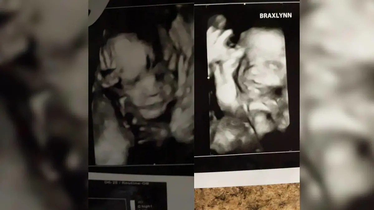 Das ungeborene Baby verstarb kurz nach der Tat im Krankenhaus.