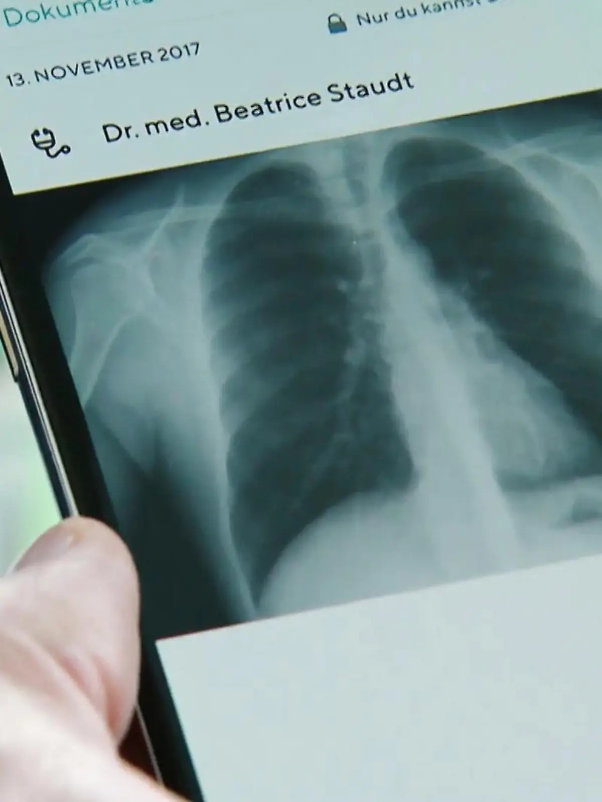 Nach jahrelangem Gezerre soll die Digitalisierung des Gesundheitswesens in Deutschland mit breit angelegten Anwendungen für alle mehr Fahrt aufnehmen. Bundesminister Karl Lauterbach hat dazu Pläne für einen Neustart der elektronischen Patientenakte vorgelegt, die als freiwilliges Angebot kaum genutzt werden.