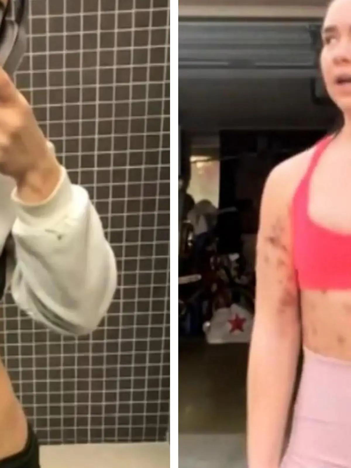 Influencerin Beatrix Amma geht seit ihrer Ankunft in Los Angeles 2021 durch die absolute Hölle!
Um ihrem Traum als Fitness-Influencerin noch ein Stückchen näherzukommen, lässt sich für umgerechnet 750 Euro ein Gemisch aus Vitaminboostern und Desoxycholsäure, einem Fettlöser, injizieren.