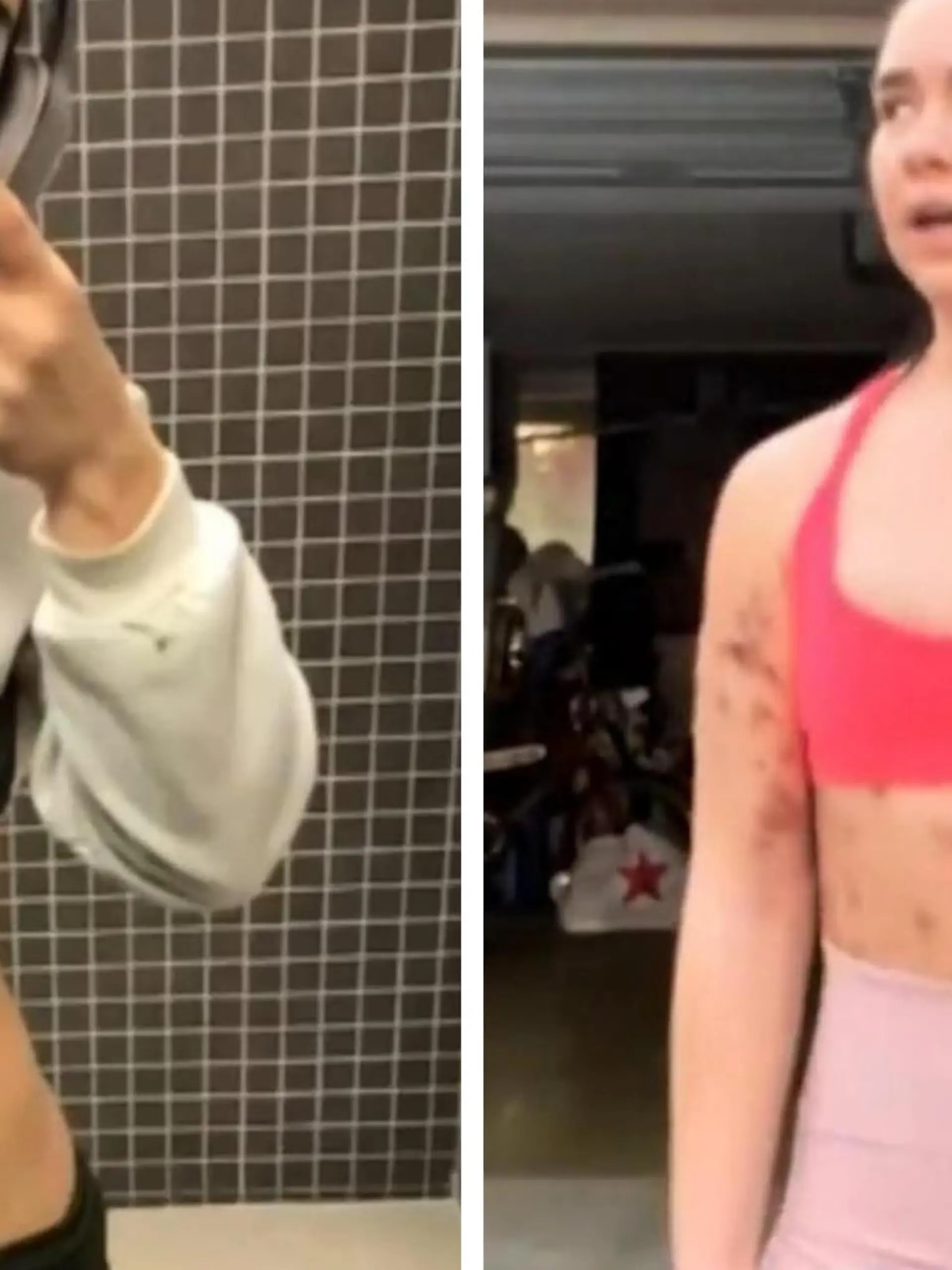 Influencerin Beatrix Amma geht seit ihrer Ankunft in Los Angeles 2021 durch die absolute Hölle!
Um ihrem Traum als Fitness-Influencerin noch ein Stückchen näherzukommen, lässt sich für umgerechnet 750 Euro ein Gemisch aus Vitaminboostern und Desoxycholsäure, einem Fettlöser, injizieren.