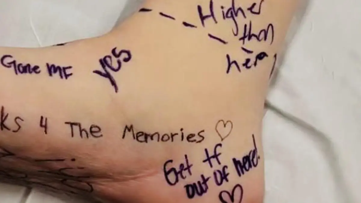 Fuß von Sierra Diller