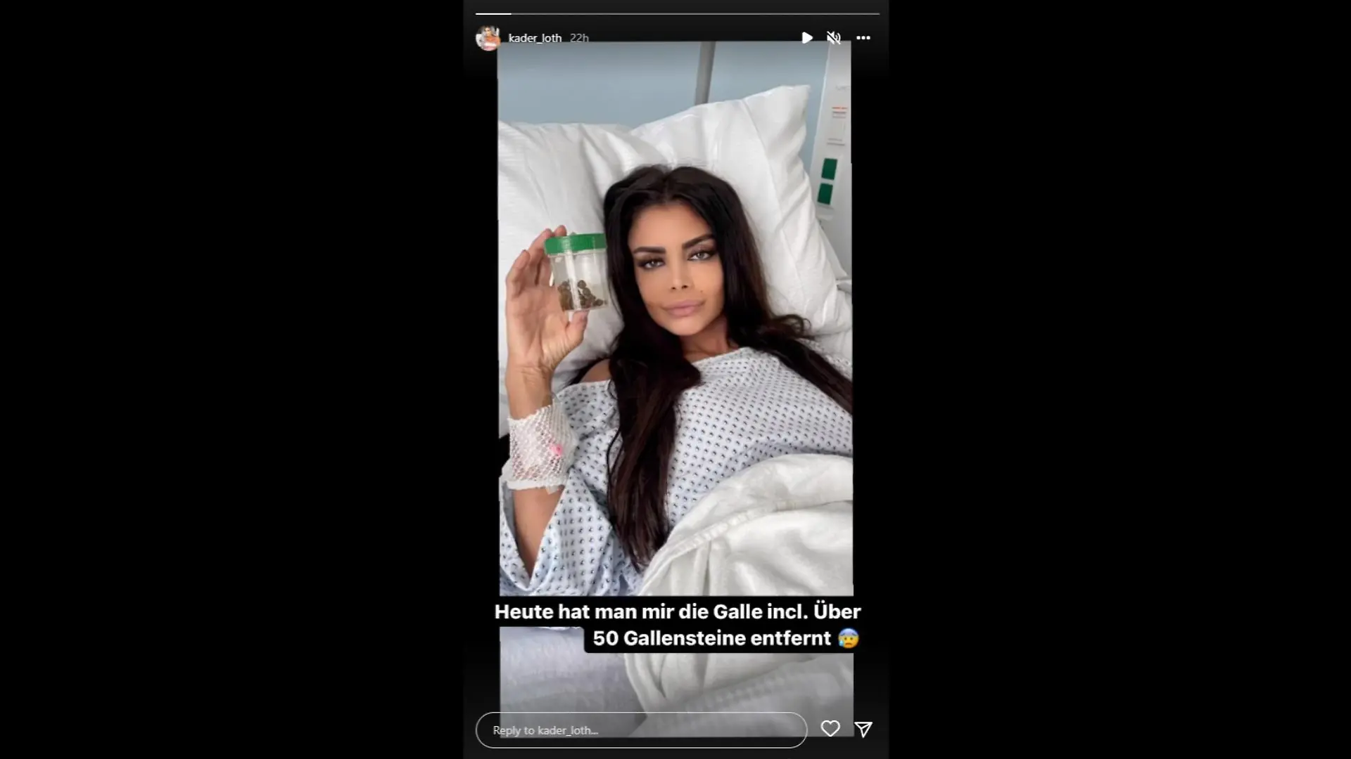 Was Kader Loth da in der Hand hält, stammt aus ihrem Körper