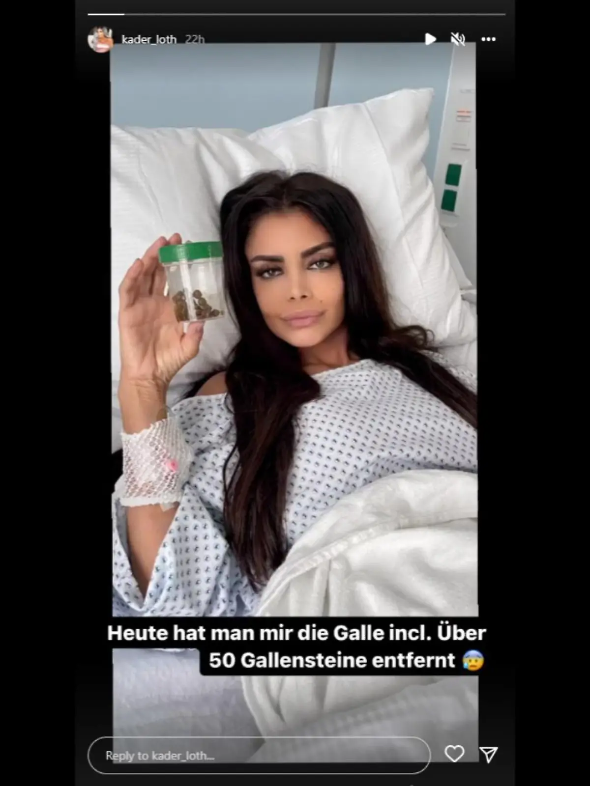 Was Kader Loth da in der Hand hält, stammt aus ihrem Körper