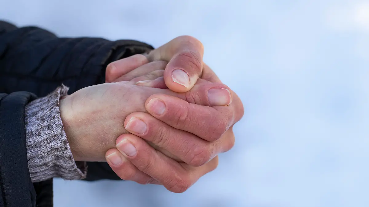 Red hands in the cold.Risk of frostbite of hand or fingers outdoors during cold weather because of frost in winter.