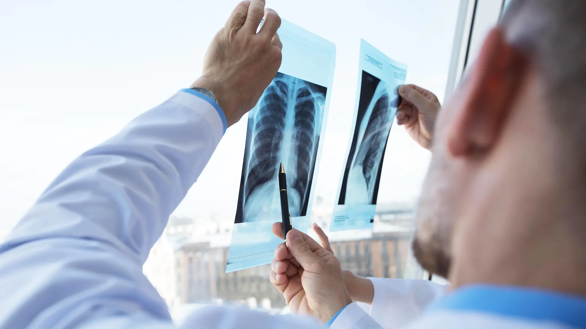 IMAGO Creative: Brustkrebsmonat Doctors discuss and looking x-ray Healthcare, medical: Group of doctors discuss and looking x-ray in a clinic or hospital, model releasedxray, medical, hospital, clinic, healthcare, health, window, radiography, examination, radiology, x-ray, diagnosis, office, surgeon, scan, doctors, image, medicine, technology, uniform, white, doctor, caucasian, practitioner, man, working, bone, cancer, team, care, anatomy, diagnostics, education, group, medics, oncologists, picture, ray, skeleton, specialist, teamwork, x, discussing, looking, people, professional, chest, injury, PUBLICATIONxINxGERxSUIxAUTxONLY
