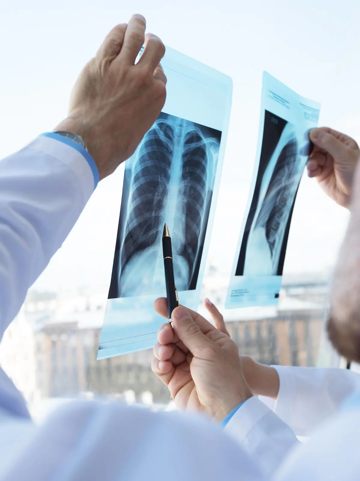 IMAGO Creative: Brustkrebsmonat  Doctors discuss and looking x-ray Healthcare, medical: Group of doctors discuss and looking x-ray in a clinic or hospital, model releasedxray, medical, hospital, clinic, healthcare, health, window, radiography, examination, radiology, x-ray, diagnosis, office, surgeon, scan, doctors, image, medicine, technology, uniform, white, doctor, caucasian, practitioner, man, working, bone, cancer, team, care, anatomy, diagnostics, education, group, medics, oncologists, picture, ray, skeleton, specialist, teamwork, x, discussing, looking, people, professional, chest, injury, PUBLICATIONxINxGERxSUIxAUTxONLY