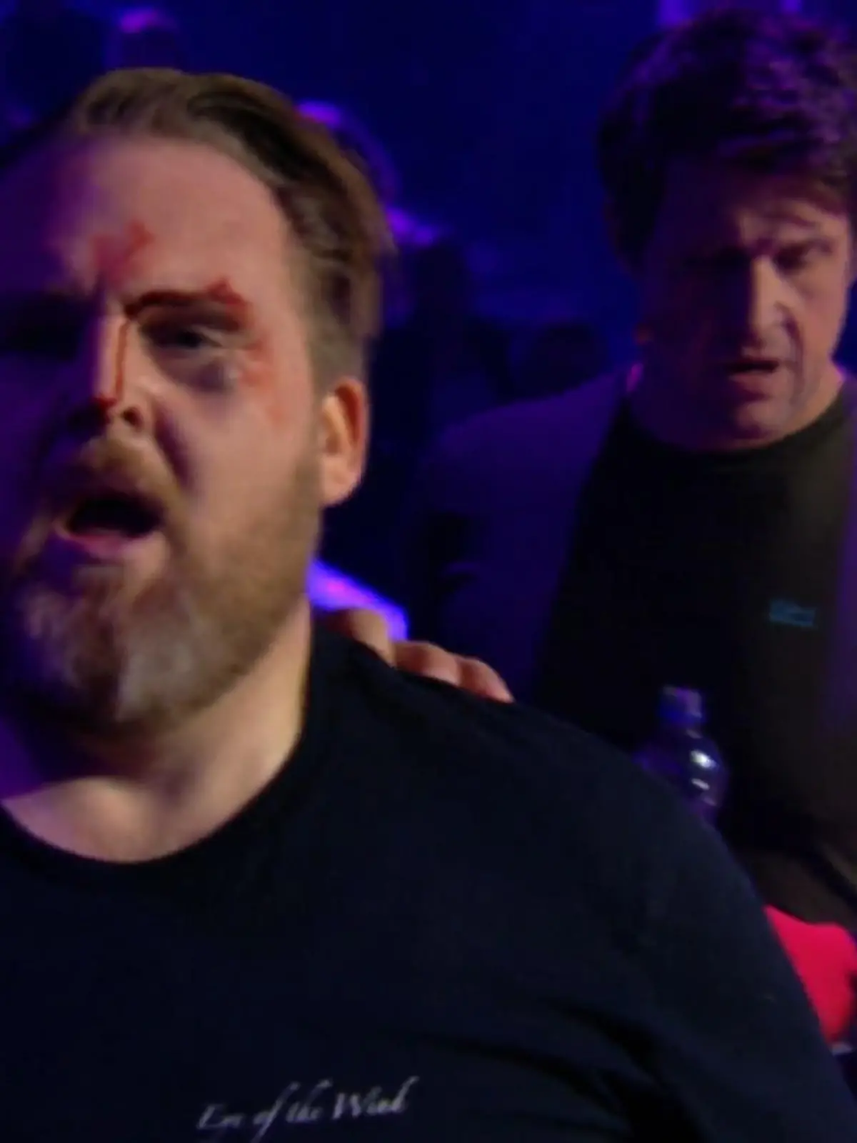 Axel Stein verletzte sich bei Schlag den Besten schwer am Auge.