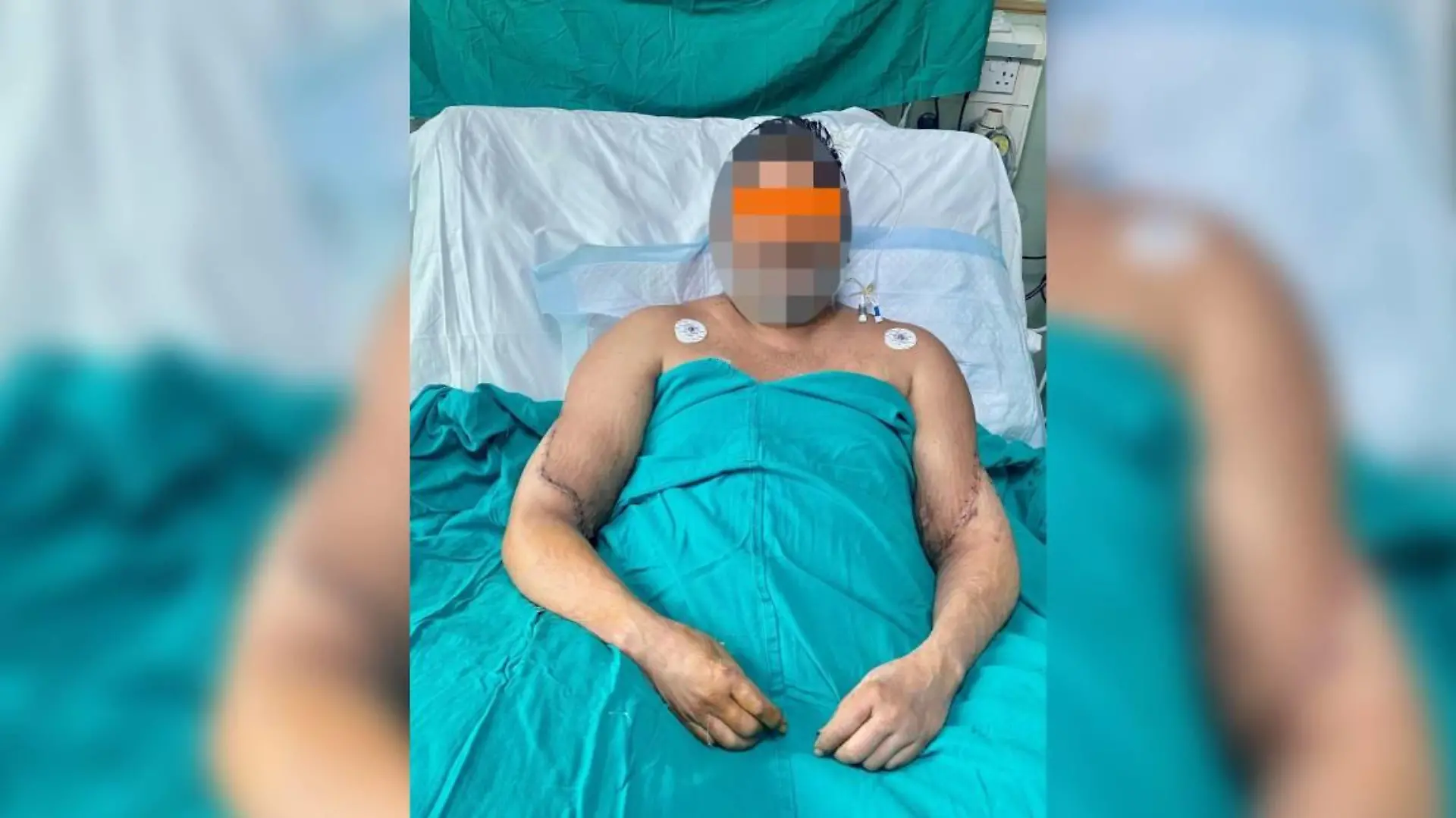 Raj Kumar nach seiner OP