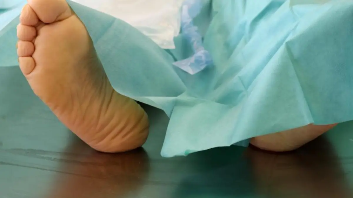 Leiche liegt auf Tisch in der Pathologie