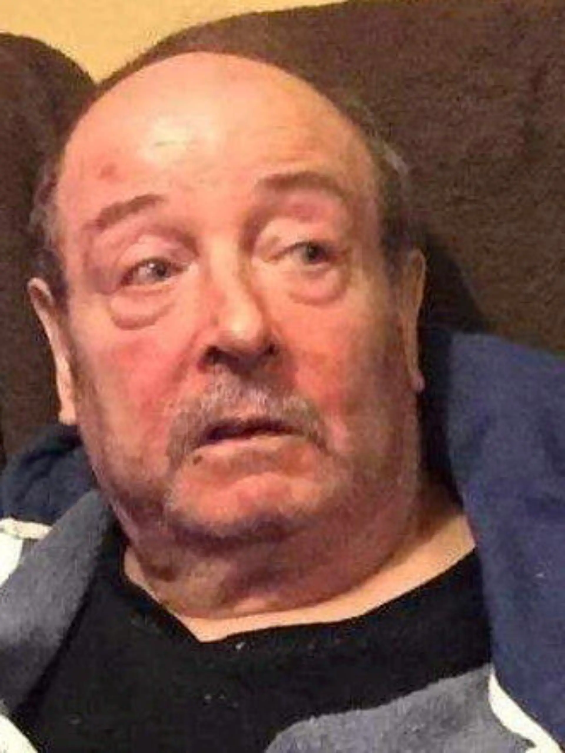 SONDERKONDITIONEN: PREISABSPRACHE! *EXCLUSIVE* 
Jeffrey Heyes in March 2022. Photo released March 12 2024. See SWNS story SWLSchoke. A furious son whose dad choked to death on a hospital sandwich after life-saving equipment failed has branded the care he received a shambles.Jeffrey Heyes, 75, who suffered from Parkinsons disease, died when a piece of food became lodged in his airways and his jaw became 'locked' in a closed position.But an inquest revealed he was allowed to eat unsupervised at Royal Albert Edward Infirmary, in Wigan, Gtr Manchester, despite bread previously being found hanging from his mouth.And when he was discovered gagging, an emergency alarm did not work correctly and a life-saving anti-choking machine failed due to flat batteries.
 / action press