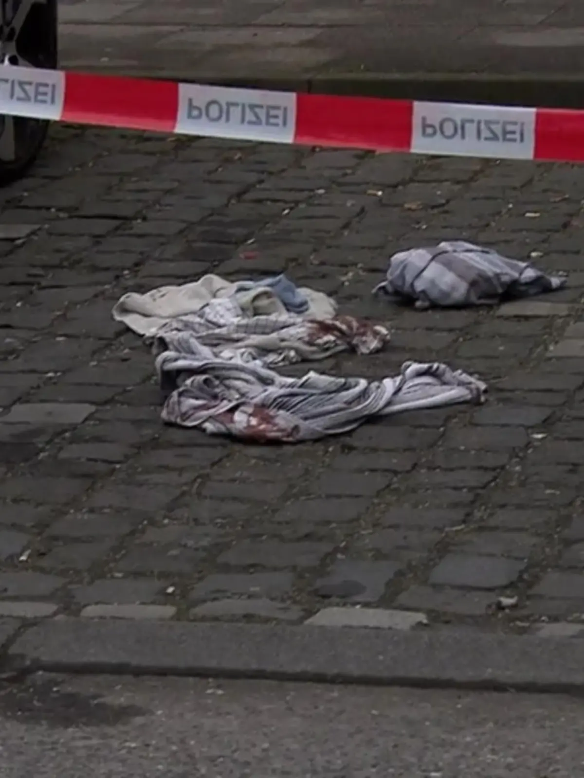 Bild zu: "Mann hat Schussverletzungen an Beinen"