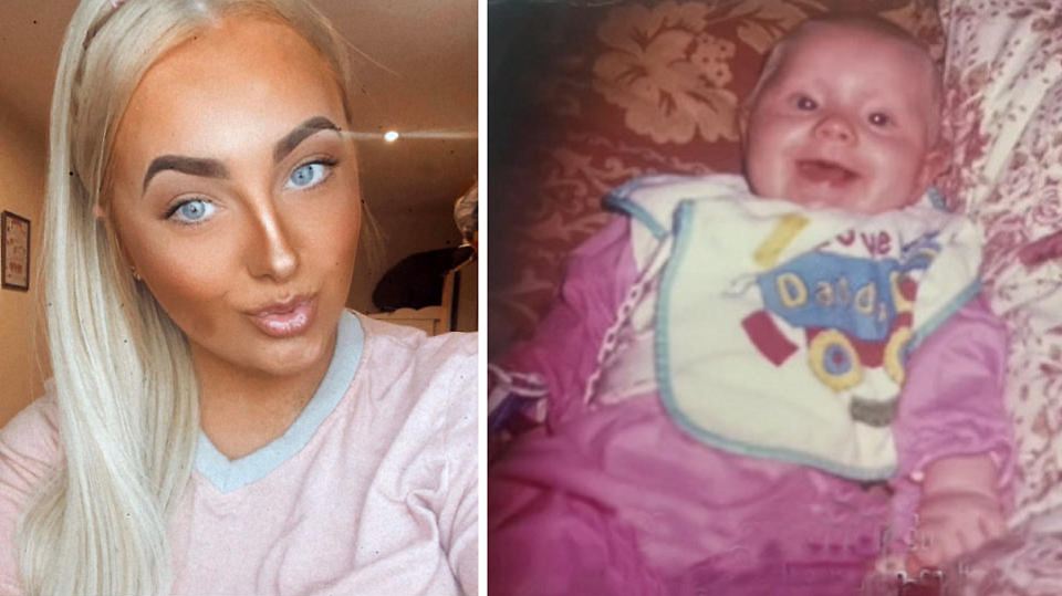 Vorzeitige Pubertät Liza hatte schon mit 18 Monaten ihre erste