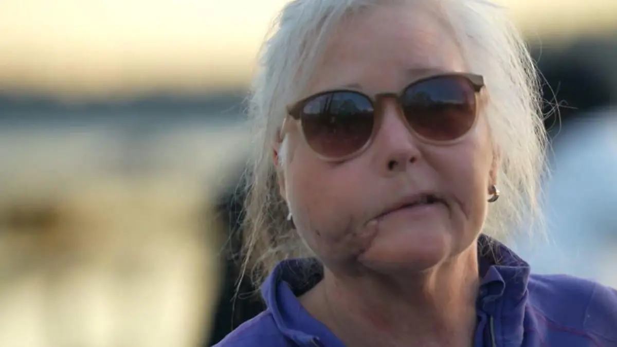 Ein Puma hatte Keri Bergere ins Gesicht gebissen.