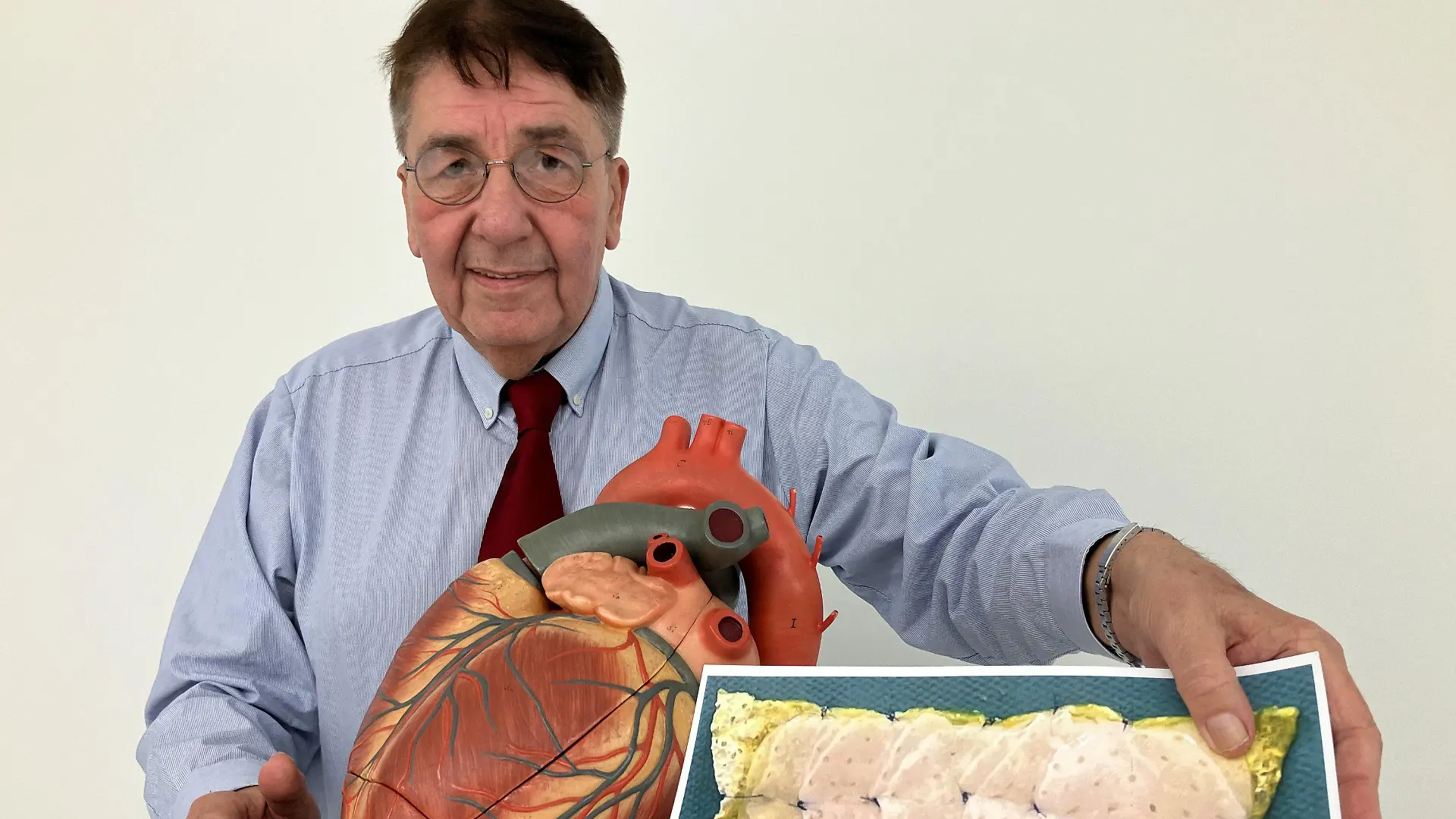 18.03.2024, Niedersachsen, Göttingen: Herzpflaster-Patient Frank Teege steht neben einem Herz-Modell und zeigt ein Bild, auf dem ein Herzpflaster zu sehen ist. Zur Behandlung von Herzmuskelschwächen haben Mediziner ein neues Medikament entwickelt. Erste Studienergebnisse des sogenannten Herzpflasters deuten auf dessen Wirksamkeit hin, wie die Wissenschaftler am Montag bei einer Pressekonferenz in Göttingen sagten. Foto: Maurice Arndt/dpa +++ dpa-Bildfunk +++