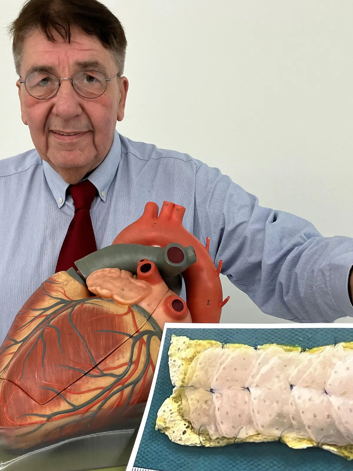 18.03.2024, Niedersachsen, Göttingen: Herzpflaster-Patient Frank Teege steht neben einem Herz-Modell und zeigt ein Bild, auf dem ein Herzpflaster zu sehen ist. Zur Behandlung von Herzmuskelschwächen haben Mediziner ein neues Medikament entwickelt. Erste Studienergebnisse des sogenannten Herzpflasters deuten auf dessen Wirksamkeit hin, wie die Wissenschaftler am Montag bei einer Pressekonferenz in Göttingen sagten. Foto: Maurice Arndt/dpa +++ dpa-Bildfunk +++