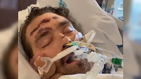 Pltzlich im Koma: Eingewachsenes Haar bringt Steven beinahe um