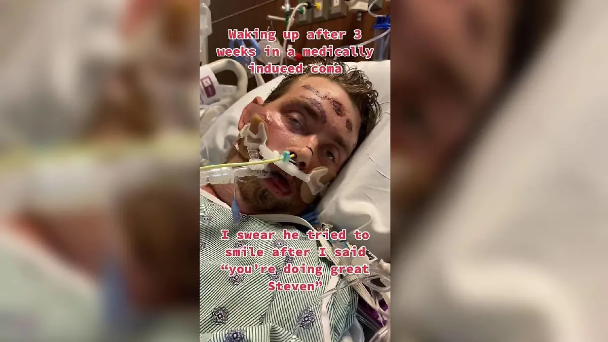 Nach drei Wochen erwacht Steven aus dem künstlichen Koma - obwohl Ärzte ihm gerade einmal eine vierprozentige Überlebenschance gegeben hatten.