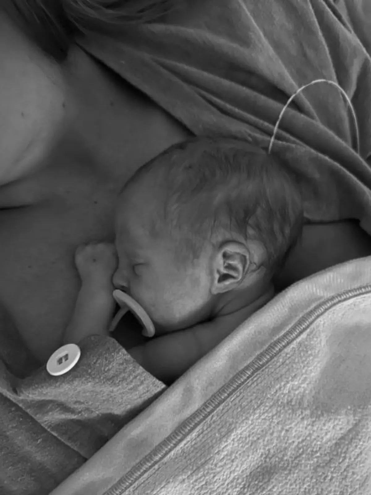 Bei einer Ultraschall-Untersuchung wurde dem Traumpaar des schwedischen Handballs mitgeteilt, dass die Zwillinge unter dem TAPS-Syndrom leiden.