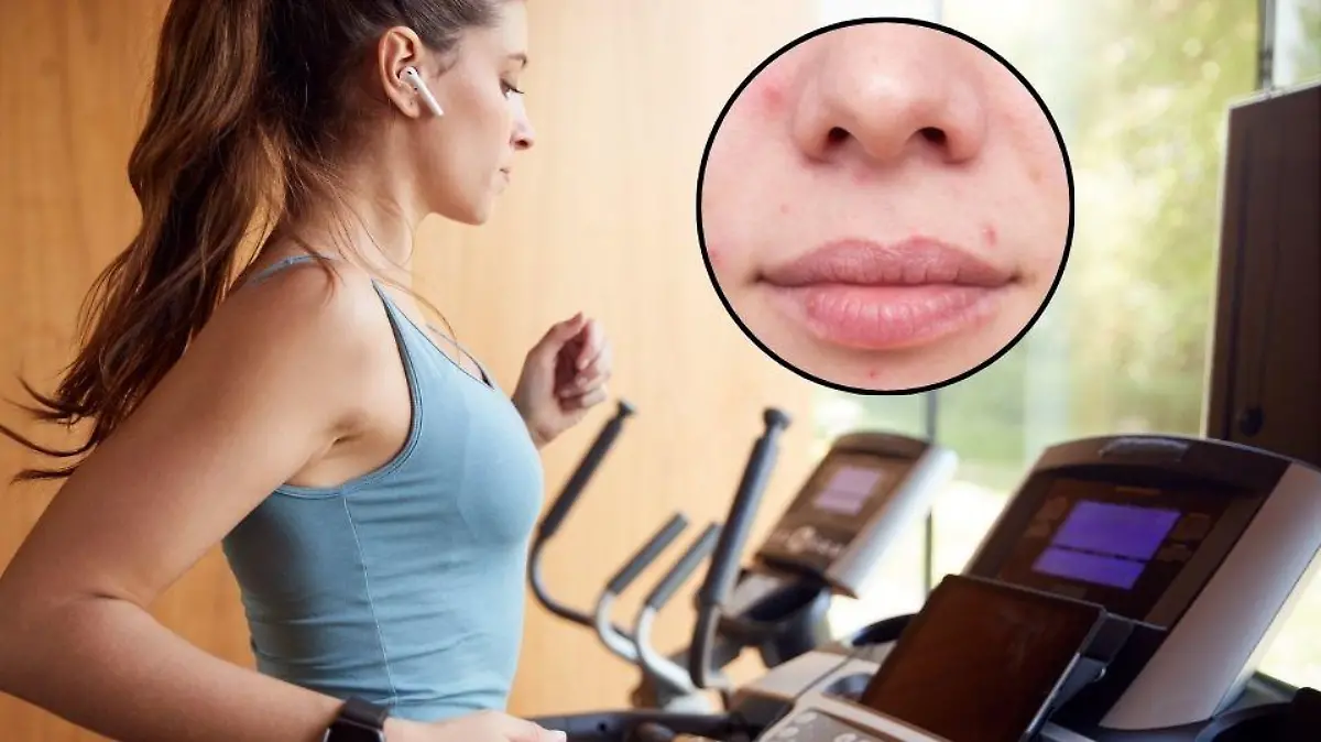 fitness laufband fitnessstudio workout Bildverwendung nur mit Urhebervermerk: Monkey Business 2/Shotshop/picture alliance. & Woman face with problematic skin