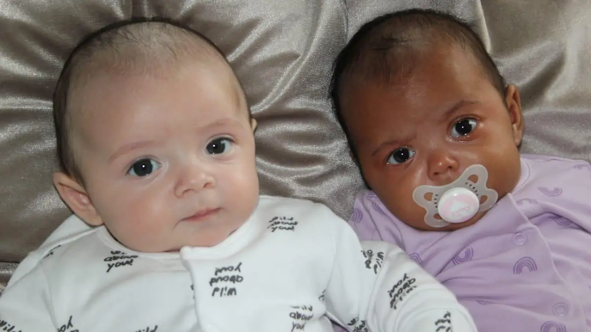 SONDERKONDITIONEN: Satzpreis!
Chantelle Broughton's twins, Azirah (darker skinned) and Ayon (fairer skinned). See SWNS story SWLNtwins. A mum was left gobsmacked after giving birth to million-to-one black and white TWINS who look like they are different races. Chantelle Broughton, 29, says she regularly gets asked 'are they both yours?' since welcoming Ayon and Azirah into the world in April. Son Ayon was born at Nottingham City Hospital with green eyes and fair skin while daughter Azirah has brown eyes and a much darker complexion. Such births are so rare, genetics experts have previously estimated them at one in a million.
/ action press