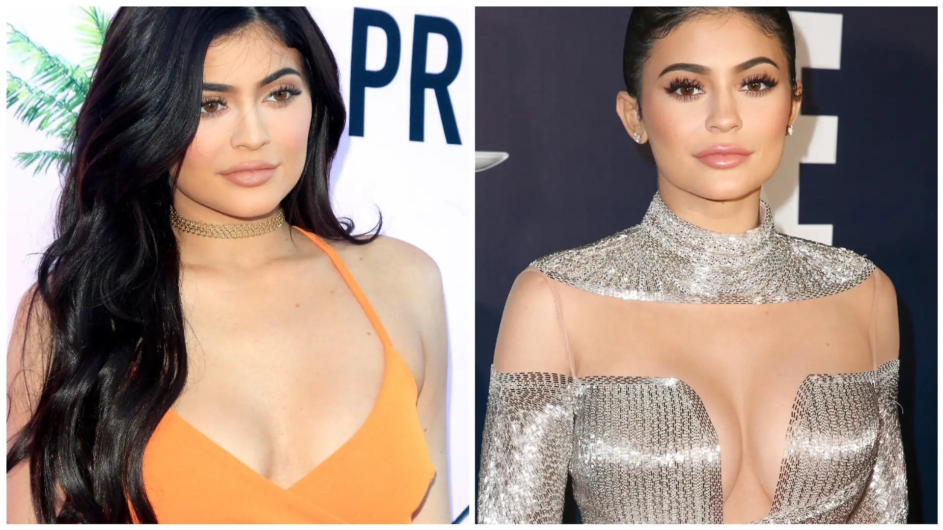 Kylie Jenner vor und nach ihrer Brust-OP