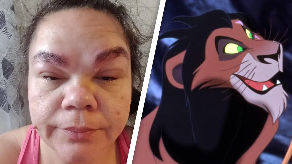 Jennifer Grajeda mit entzündeten und geschwollenen Augenbrauen