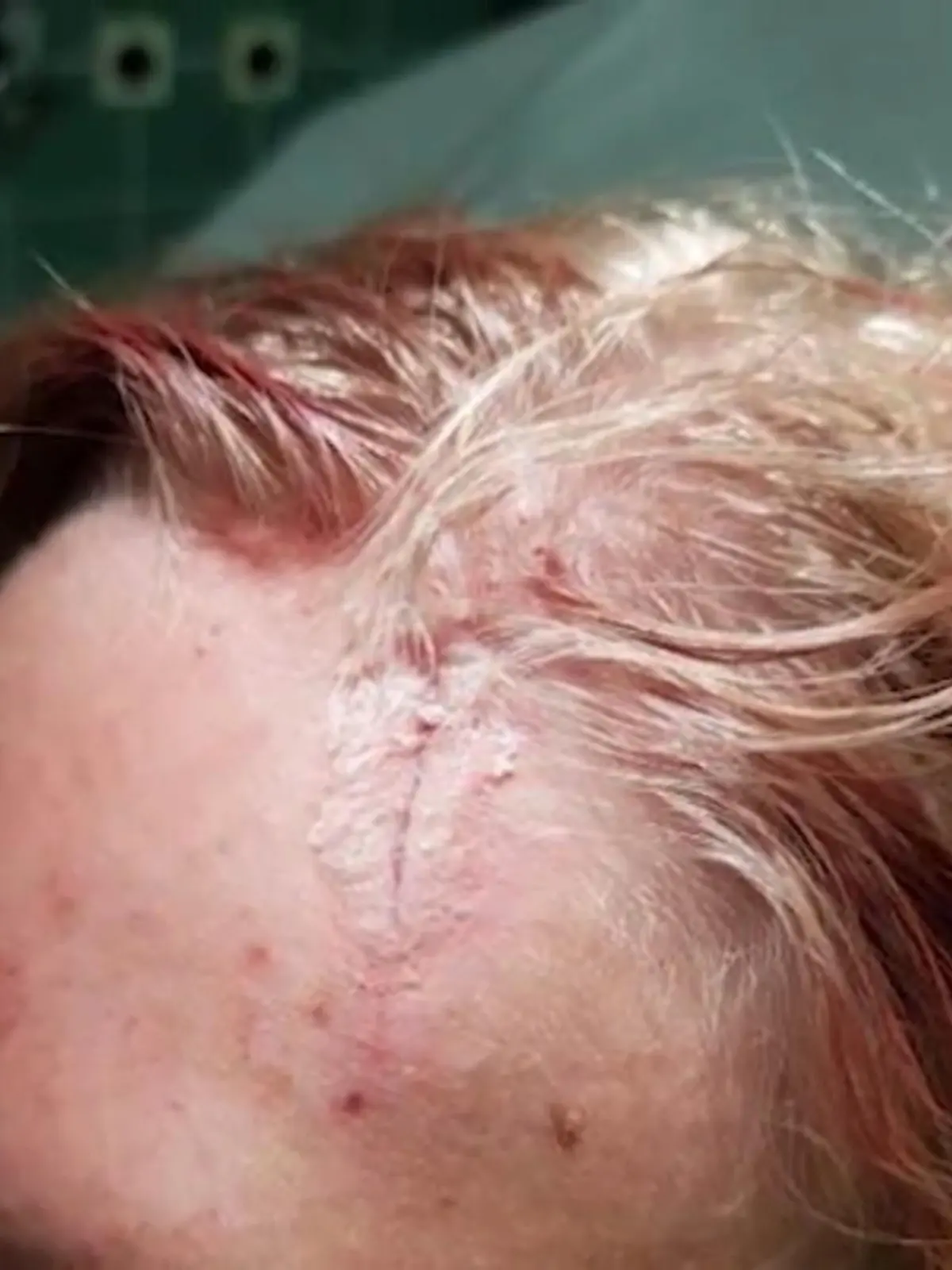 Ein 14-jähriger Junge aus Schottland ist wegen einer TikTok-Challenge gestorben. Seit Wochen gibt es auf der Plattform die sogenannte Blackout-Challenge. Auch Laura aus Deutschland hat mitgemacht und sich dabei schwer verletzt. Was ihr passiert ist und warum die Challenge lebensgefährlich ist, zeigen Ihnen Bella Christophel und Franca Pörsch im Video.