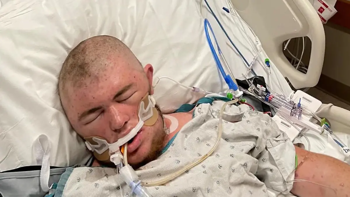 Austin Bellamy (20) wurde über 20.000 Mal von Killerbienen gestochen.