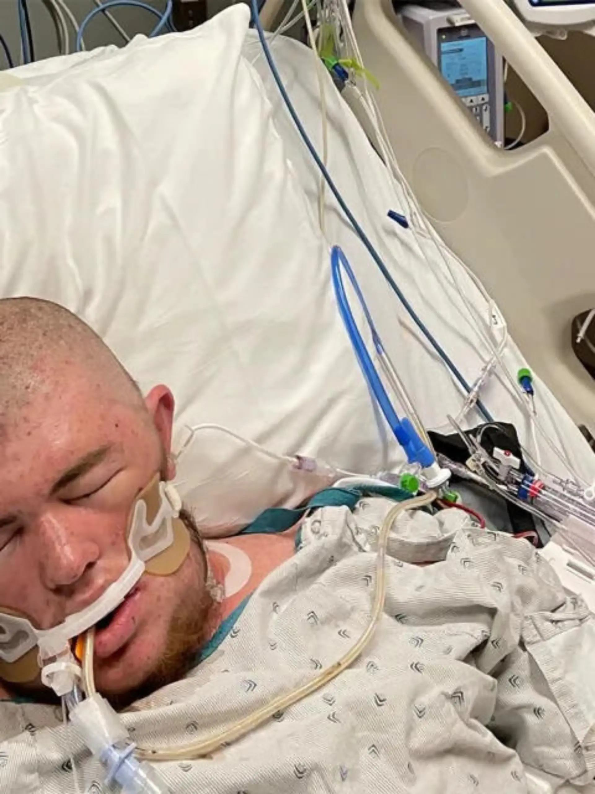 Austin Bellamy (20) wurde über 20.000 Mal von Killerbienen gestochen.
